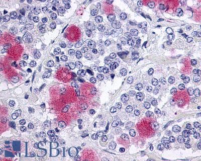 PathPlus™ GLP2R Antibody (C-Terminus)