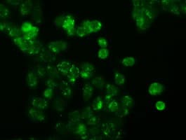APP / Beta Amyloid Precursor Antibody (clone OTI5F1)