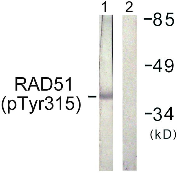 RAD51 / RECA Antibody (phospho-Tyr315)