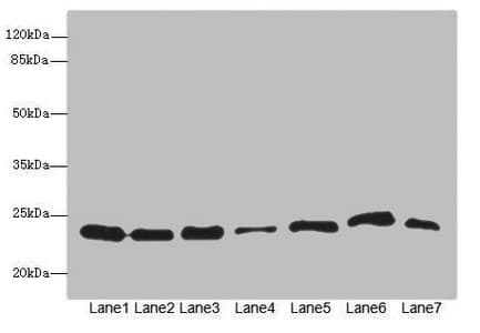 Polyclonal Rabbit anti-Human PSMB3 Antibody (IHC, WB)