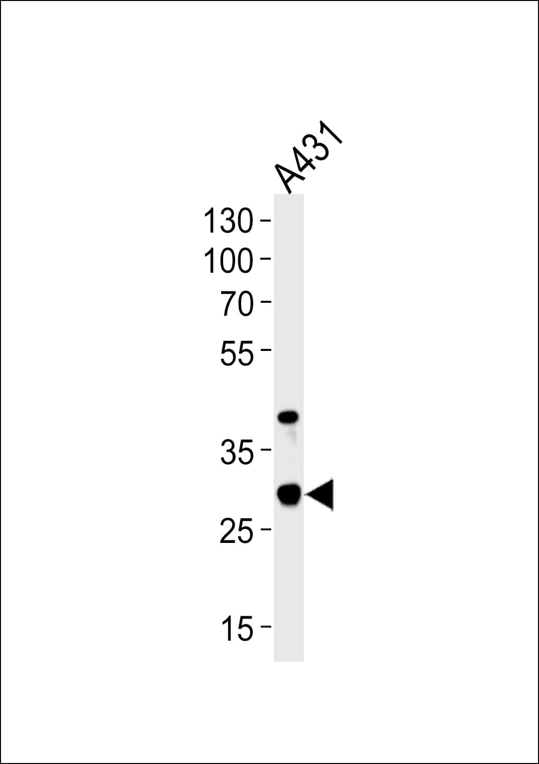 JAM2 Antibody (aa63-91)