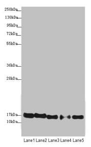 ATP5D Antibody