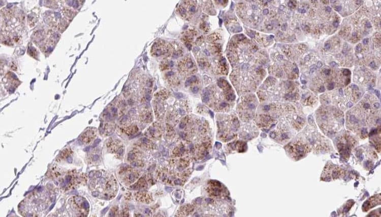 Polyclonal Rabbit anti-Human PPIC / Cyclophilin C Antibody (IHC, WB)
