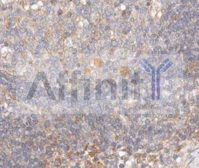 Polyclonal Rabbit anti-Human MAPK3 / ERK1 Antibody (IHC, IF, WB)