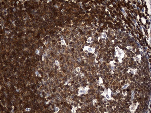 CRLF3 Antibody (clone OTI2A9)