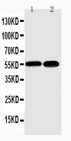 NFKB2 Antibody (aa5-21)