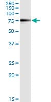 Monoclonal Mouse anti-Human GNT-III / MGAT3 Antibody (clone 2G4, WB)