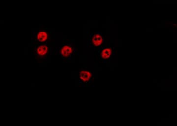 GSCL / GSC2 Antibody
