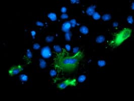 BAIAP2 / IRSP53 Antibody (clone OTI8G8)