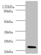 IHC-plus™ IFNA2 / Interferon Alpha 2 Antibody