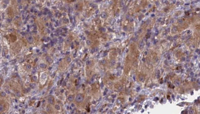 ALK-6 / BMPR1B Antibody