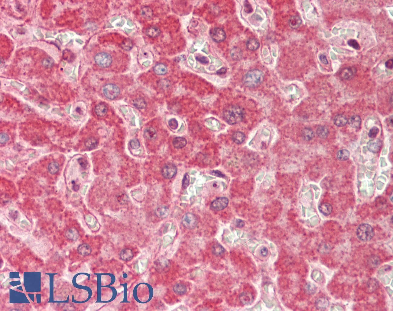 IHC-plus™ Polyclonal Rabbit anti-Human SPRED1 Antibody (IHC, WB)