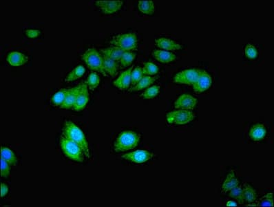 Polyclonal Rabbit anti-Human NANOS2 / NOS2 Antibody