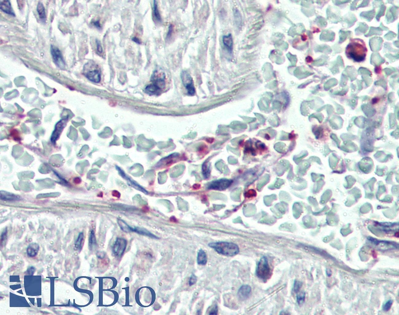 IHC-plus™ PLEK / Pleckstrin Antibody (aa337-350)