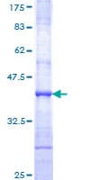 Human SOS2 Protein (Recombinant GST, N-terminus)