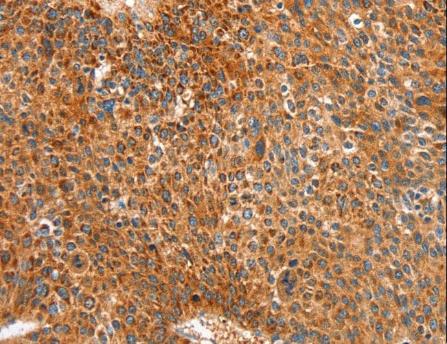 RALDH2 / ALDH1A2 Antibody