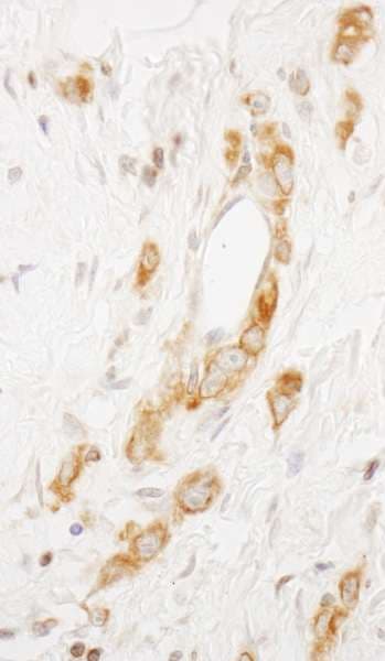 Polyclonal Rabbit anti-Human EML4 Antibody (aa150-200, IHC, WB)