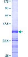 Human CASP1 / Caspase 1 Protein (Recombinant GST, N-terminus)
