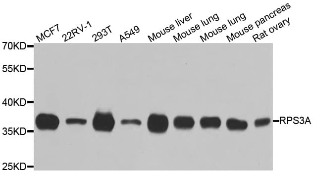 RPS3A / Ribosomal Protein S3A Antibody
