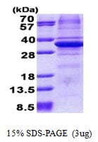 Human CA11 / Carbonic Anhydrase XI Protein (Recombinant His)