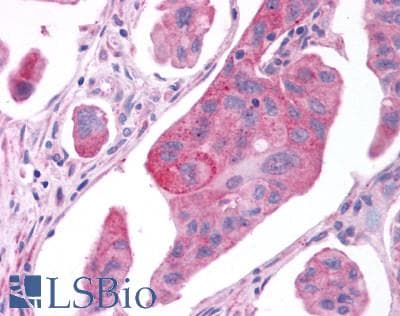 PathPlus™ Polyclonal Rabbit anti-Human GPER1 / GPR30 Antibody (C-Terminus, IHC, IF, WB)