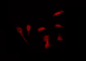 APP / Beta Amyloid Precursor Antibody (phospho-Thr743,pThr668)