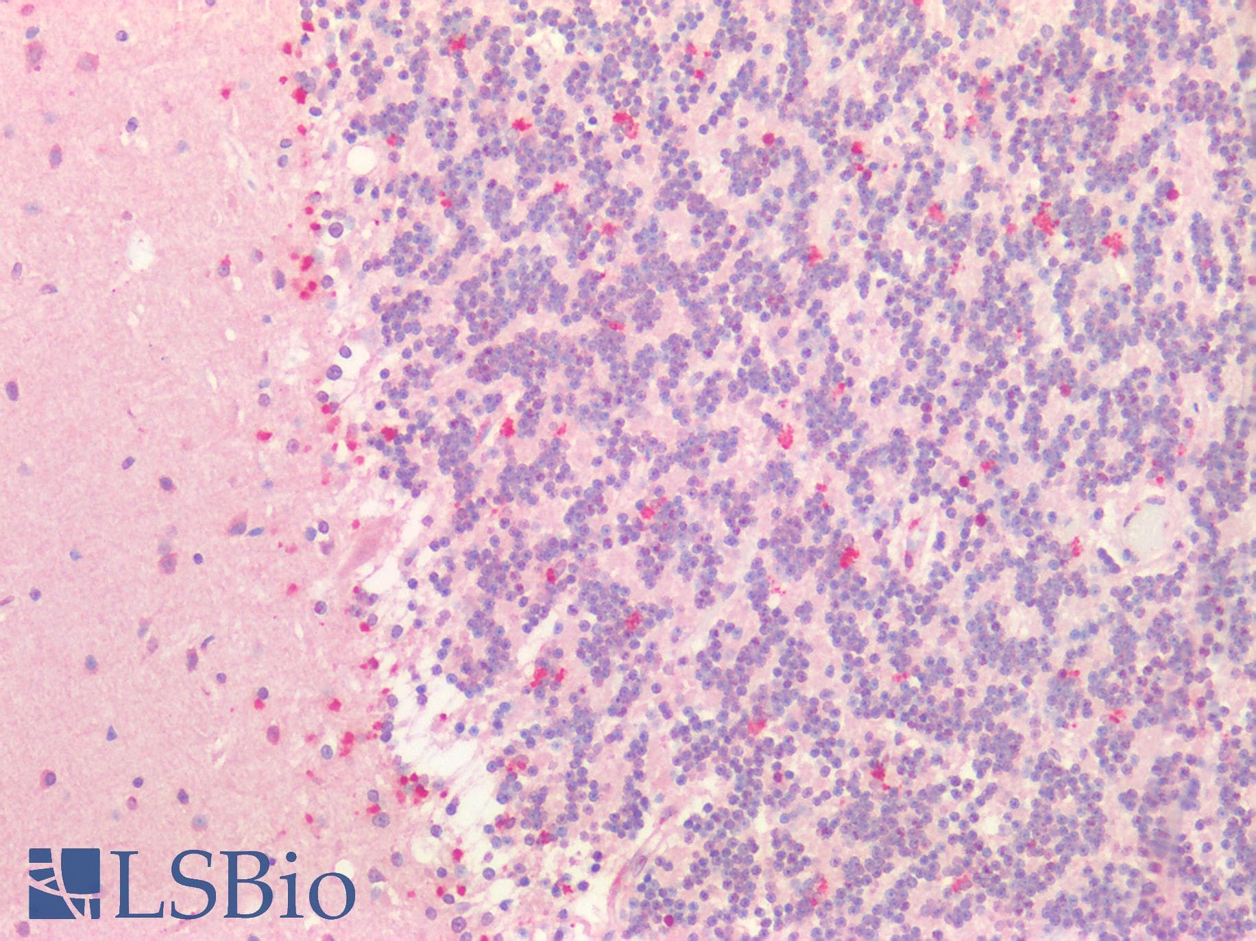 Polyclonal Rabbit anti-Human PMP22 Antibody (IHC, WB)