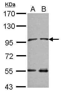 NARG1 / NAA15 Antibody (C-Terminus)