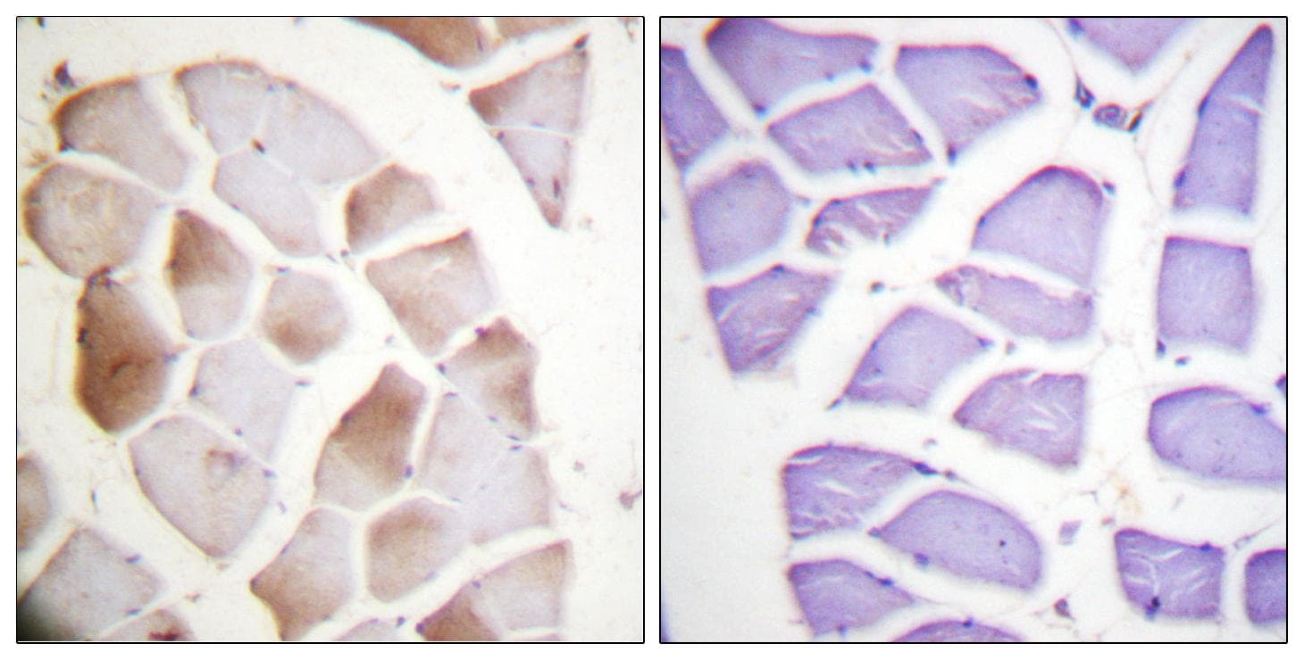 Polyclonal Rabbit anti-Human ALOX5 / 5-LOX Antibody (phospho-Ser271, IHC, WB)