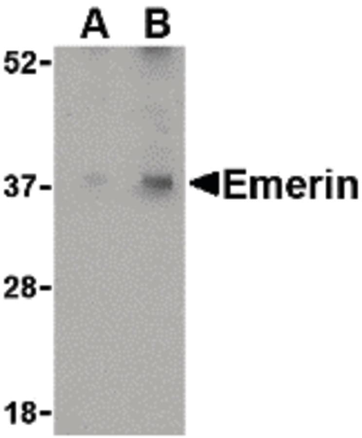 IHC-plus™ Polyclonal Rabbit anti-Human EMD / Emerin Antibody (IHC, IF, WB)