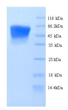 Human UGT1A / UGT1A1 Protein (Recombinant 6His, N-terminus)