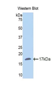 NNMT Antibody (aa127-249)