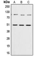 Polyclonal Rabbit anti-Human NFKB1 / NF-Kappa-B Antibody (Internal, IHC, IF, WB)