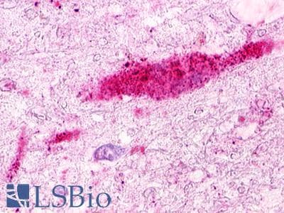 PathPlus™ GPRC5D Antibody (Extracellular Domain)