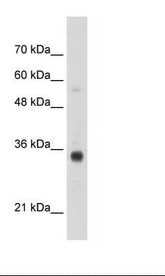 Polyclonal Rabbit anti-Human HOXB4 Antibody (N-Terminus, WB)
