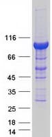 Human PDXDC1 Protein (Recombinant Myc-DDK (Flag))