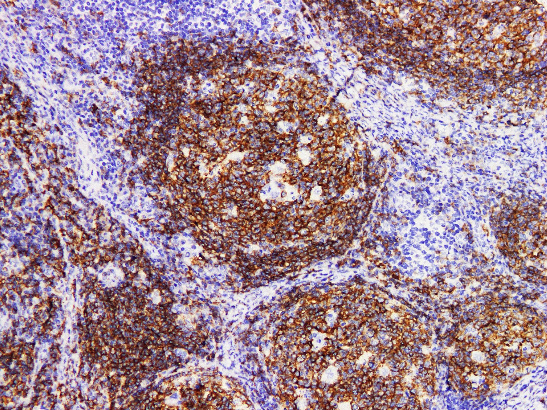 Monoclonal Rabbit anti-Human CD19 Antibody (IHC)