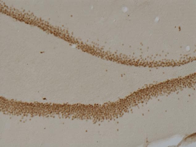 PROX1 Antibody (clone 5G10)