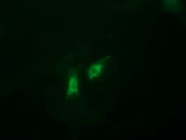 CATIP / C2orf62 Antibody (clone OTI1A6)