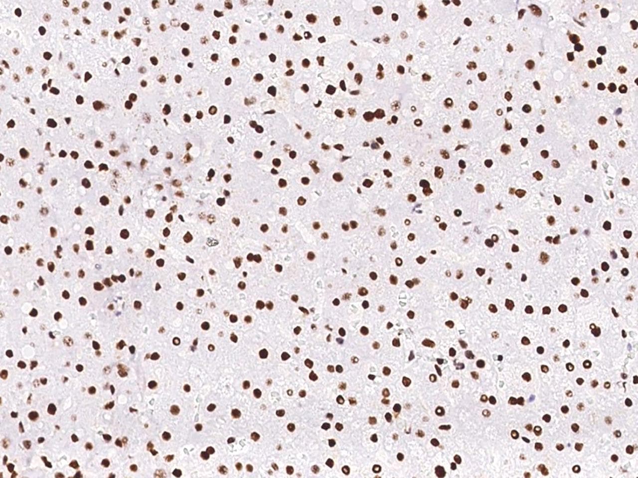Monoclonal Rabbit anti-Human PCNA Antibody (clone 144, Preservative Free, IHC)