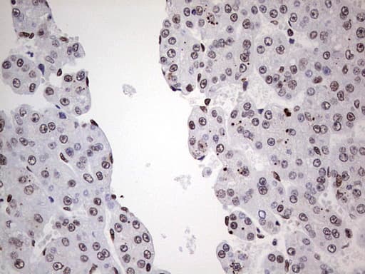 SAE1 Antibody (clone OTI3C3)
