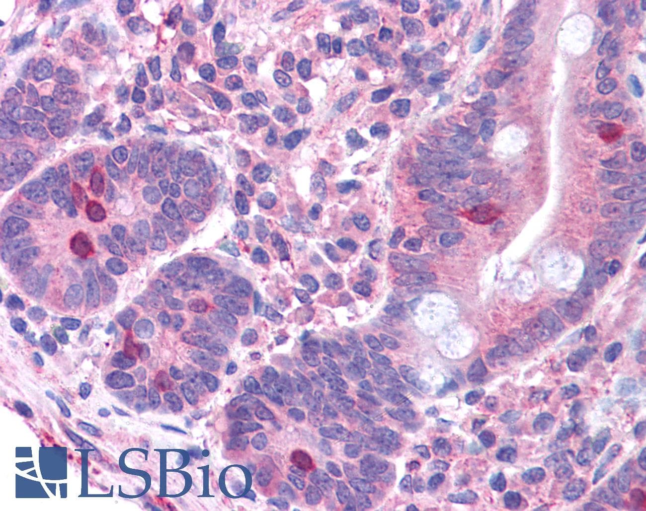 IHC-plus™ Polyclonal Goat anti-Human GNAT3 / Gustducin Antibody (aa304-318, IHC)
