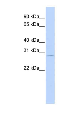 Polyclonal Rabbit anti-Human EXOSC7 Antibody (aa36-85, WB)