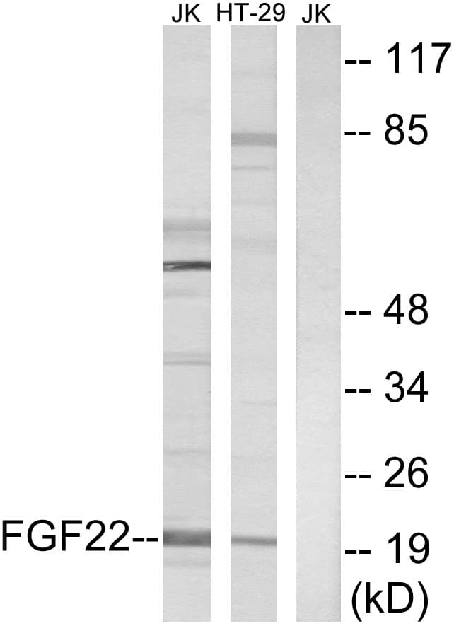 FGF22 Antibody (aa71-120)