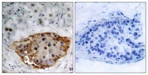 PTEN Antibody (phospho-Ser370)