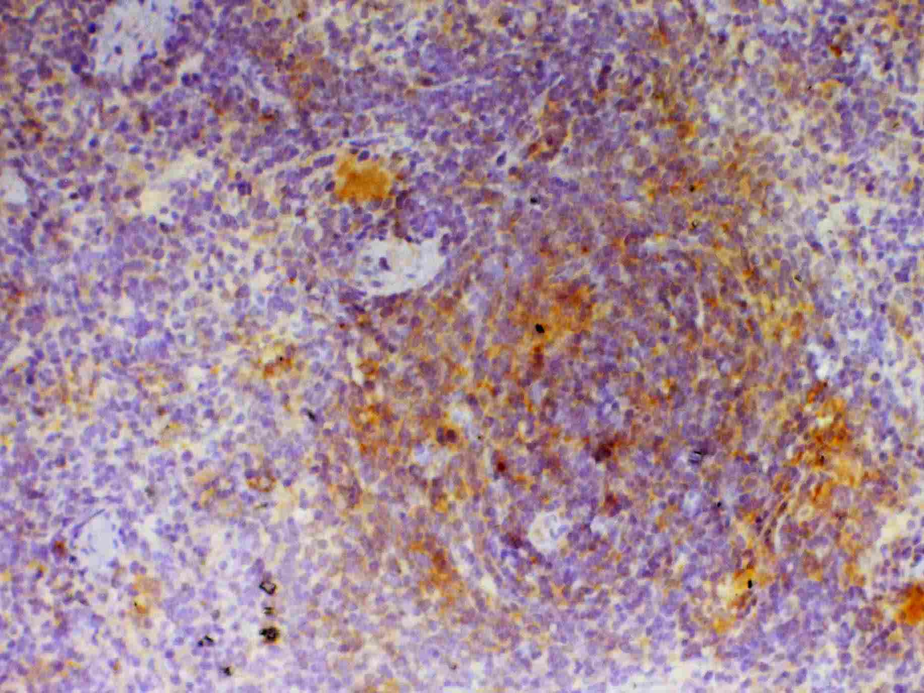 CD40L Antibody