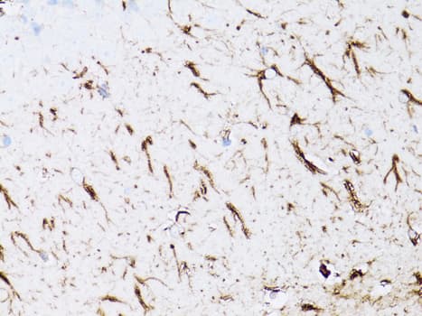 GFAP Antibody