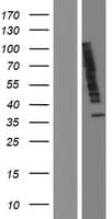 Human Ubiquilin 2 / UBQLN2 Protein (Over-Expression Lysate Myc-DDK (Flag))