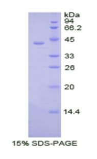 Human PDHA1 / PDH E1 Alpha Protein (Recombinant His)