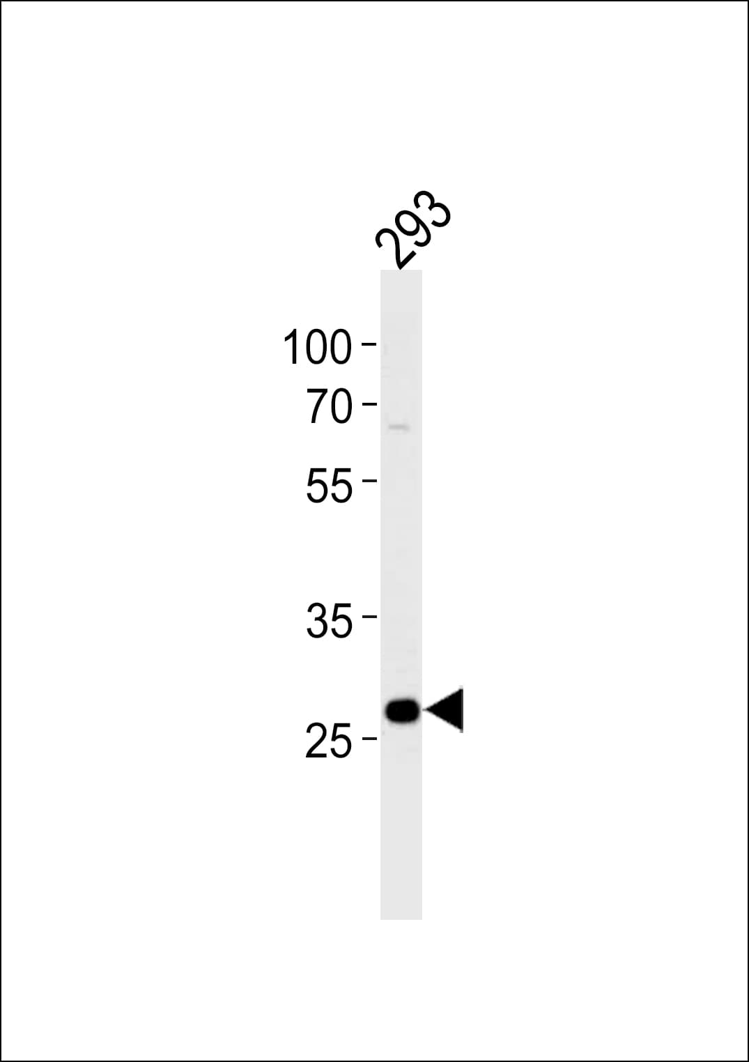 Polyclonal Rabbit anti-Human PRB4 Antibody (aa100-130, WB)